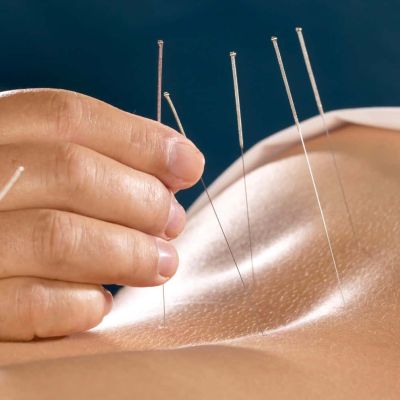 Anatomical Acupuncture in the Glebe